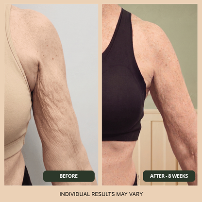 SINAVOS™ Peptide Body Oil